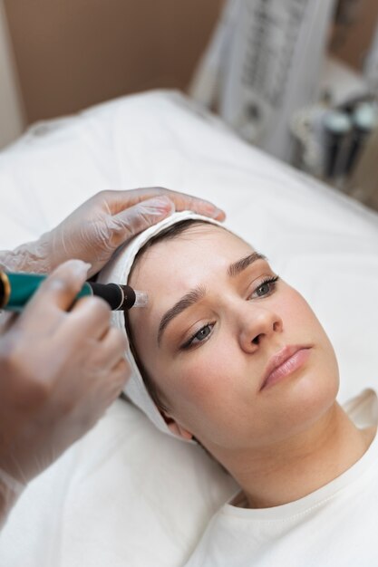 depilacion laser facial